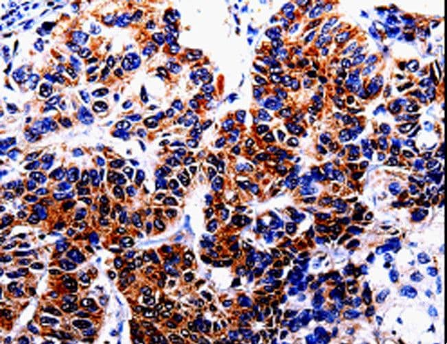 HTR2B / 5-HT2B Receptor Antibody