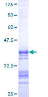 Human SST / Somatostatin Protein (Recombinant GST, N-terminus)