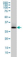 IHC-plus™ HADH Antibody (clone 4B5)