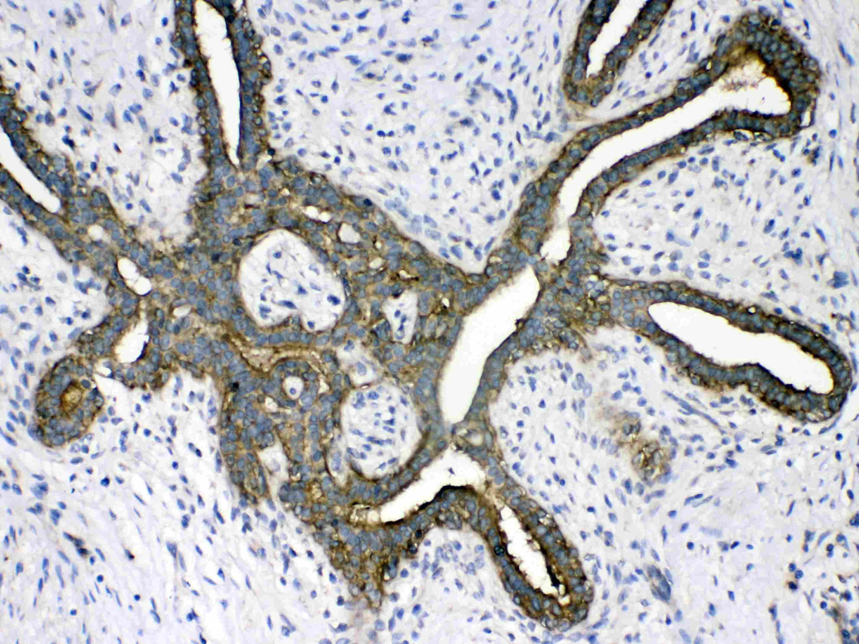 PSAT1 Antibody