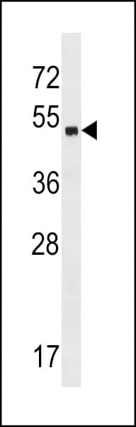 ZNF559 Antibody (aa196-224)