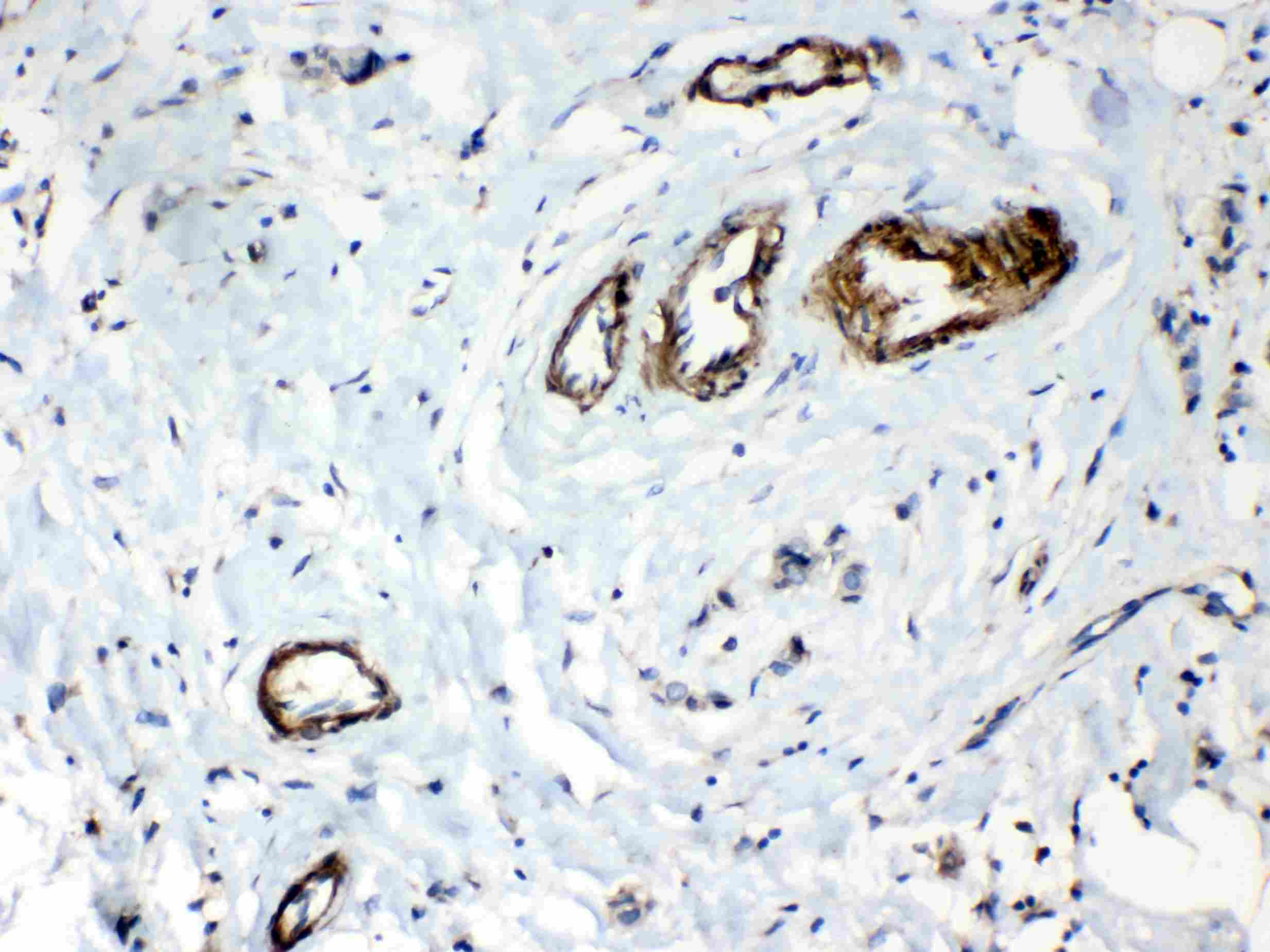 HSPB8 / H11 / HSP22 Antibody