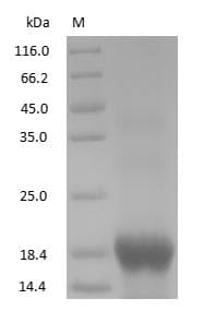 MB / Myoglobin Protein (Native)