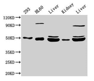 Polyclonal Rabbit anti-Human NADK2 / C5orf33 Antibody (IHC, WB)
