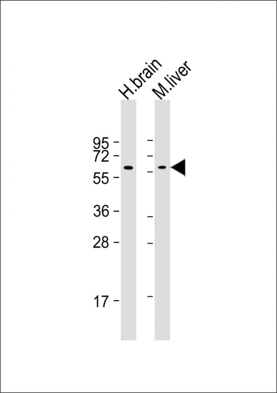 GLS2 / Glutaminase 2 Antibody (clone 1758CT879.217.60)