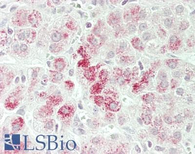 IHC-plus™ Polyclonal Rabbit anti-Human CPM / Carboxypeptidase M Antibody (aa212-241, IHC, WB)