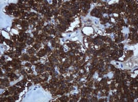 TAPBPL / TAPBPR Antibody (clone OTI2D6)