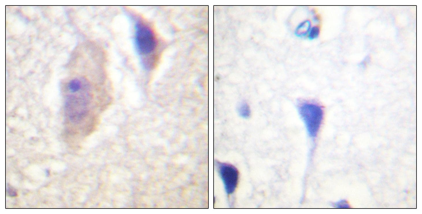 CML / BCR Antibody (phospho-Tyr360)