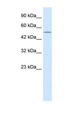 Polyclonal Rabbit anti-Human NMUR2 Antibody (N-Terminus, IHC, WB)
