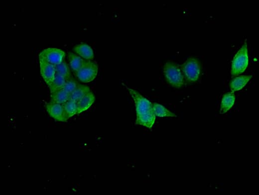 Polyclonal Rabbit anti-Human GABARAPL1 / ATG8 Antibody (IHC, IF)