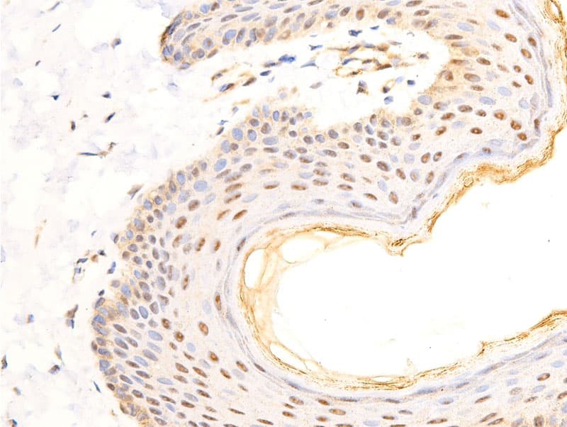 ERBB2 / HER2 Antibody (phospho-Tyr1248)