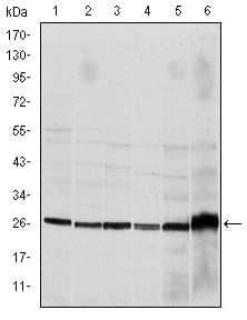 Monoclonal Mouse anti-Human CASP8 / Caspase 8 Antibody (clone 1H11, IHC, WB)