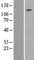 RBL2 / RB2 p130 Protein (Over-Expression Lysate Myc-DDK (Flag))
