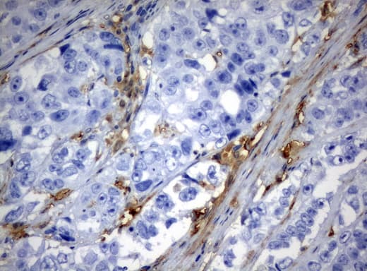 Monoclonal Mouse anti-Human TP / Thymidine Phosphorylase Antibody (clone UMAB90, aa311-482, IHC, WB)