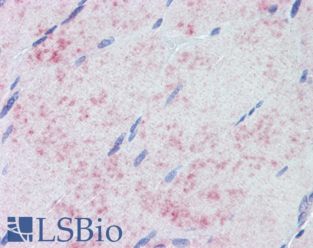 IHC-plus™ PDK1 Antibody