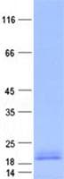 Human MAP1LC3C / LC3C Protein (Recombinant His, N-Terminal)