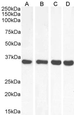 IHC-plus™ Polyclonal Goat anti-Human MDH / MDH2 Antibody (Internal Region, IHC, WB)