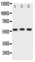 PKM / Pyruvate Kinase, Muscle Antibody (aa77-91)