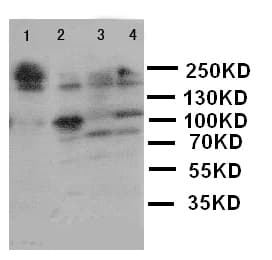 Polyclonal Rabbit anti-Human LAMC2 / Laminin Gamma 2 Antibody (aa1160-1180, IHC, WB)