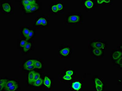 Polyclonal Rabbit anti-Human TINAGL1 / Lipocalin 7 Antibody