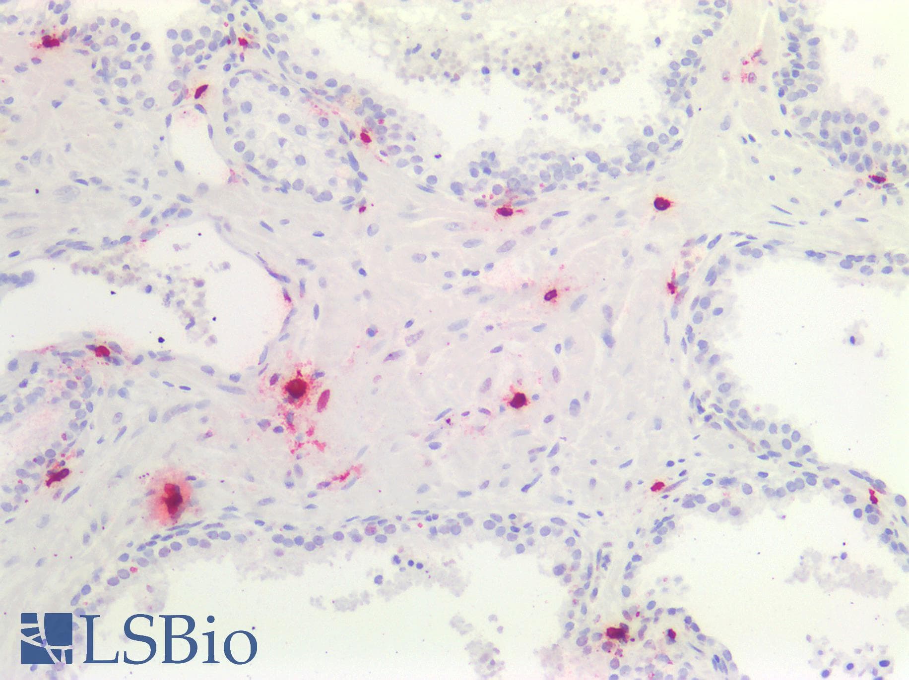 TPSAB1 / Mast Cell Tryptase Antibody (clone G3)