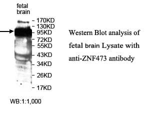 ZNF473 Antibody (aa341-634)
