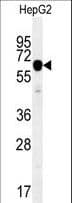 IGF2BP2 Antibody (aa530-556)
