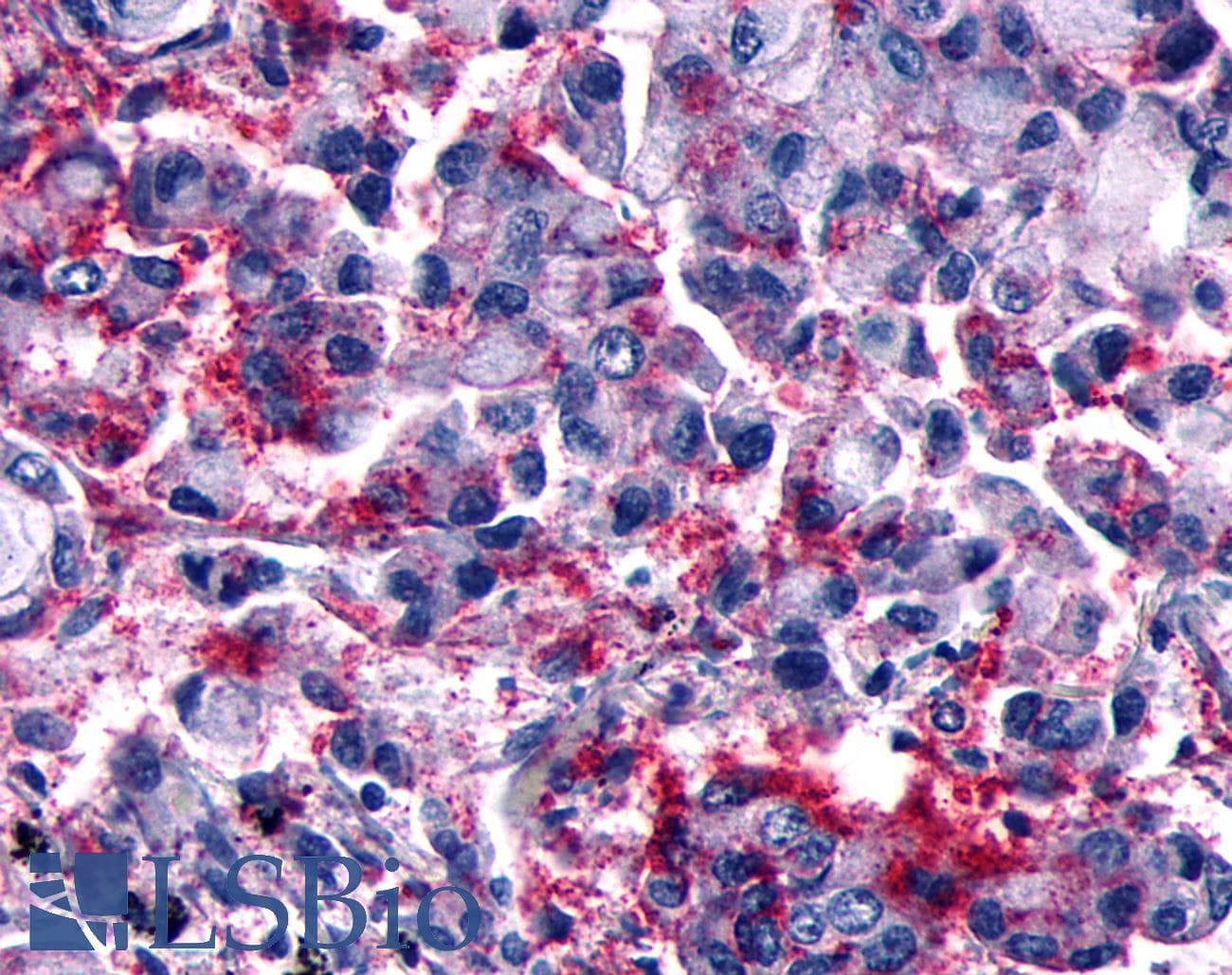 PathPlus™ GPCR6 / GPR101 Antibody (Cytoplasmic Domain)