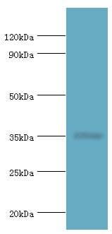 RAD51L3 / RAD51D Antibody (aa1-328)