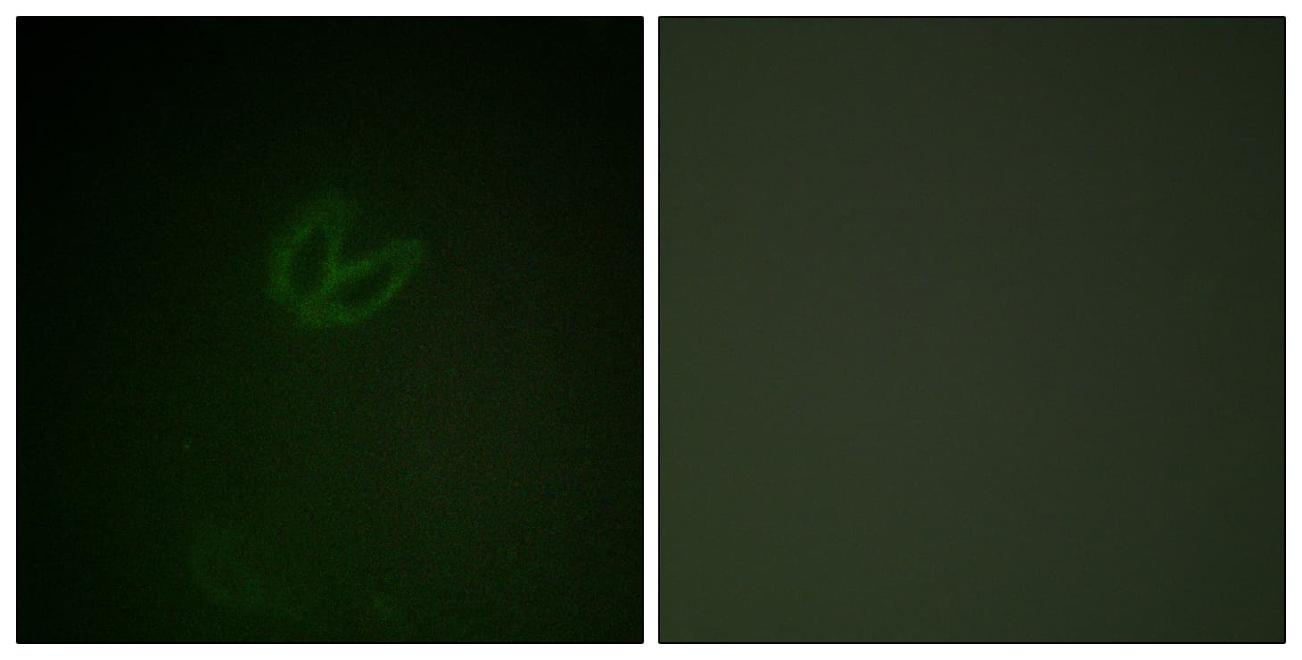 Polyclonal Rabbit anti-Human SYK Antibody (phospho-Tyr323, IHC, IF, WB)
