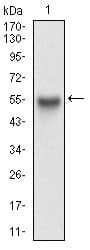 Monoclonal Mouse anti-Human APP / Beta Amyloid Precursor Antibody (clone 5H10A10, WB)