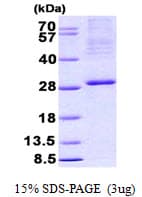 Human ITGB3BP Protein (Recombinant His)