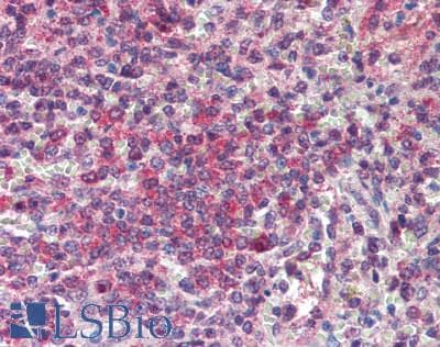 IHC-plus™ Polyclonal Rabbit anti-Human POLG Antibody (IHC, WB)