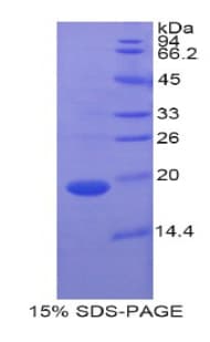 Pig CRBPIV / RBP7 Protein (Recombinant His-T7)