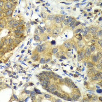 Dipeptidyl Peptidase 3 / DPP3 Antibody