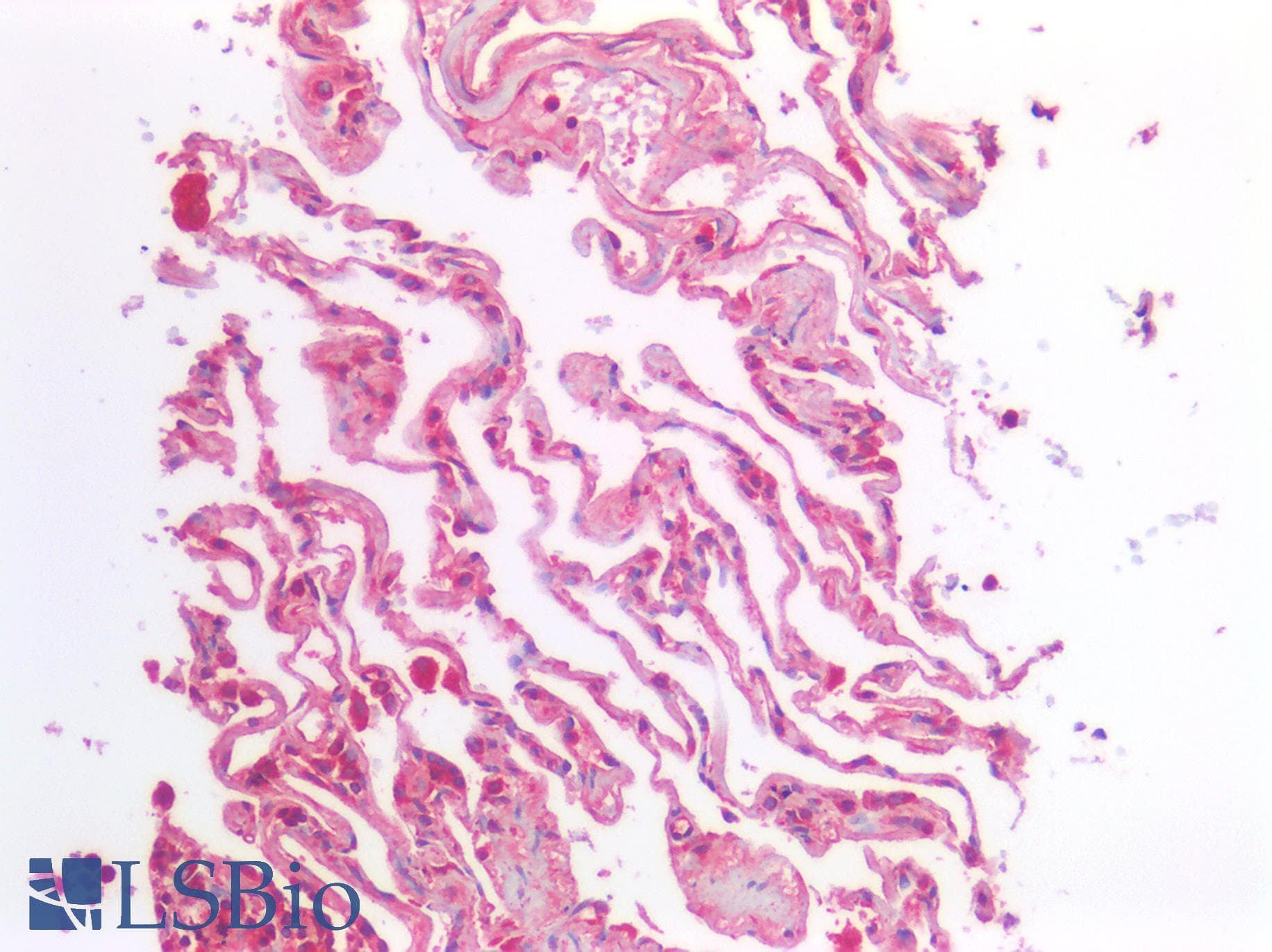 IHC-plus™ Polyclonal Rabbit anti-Human GAD1 / GAD67 Antibody (IHC)