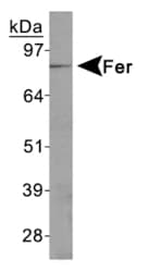 FER Antibody (Internal)