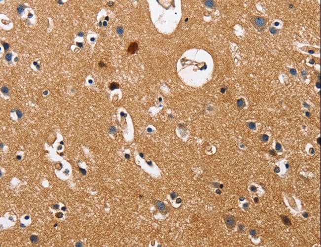 GNA13 Antibody