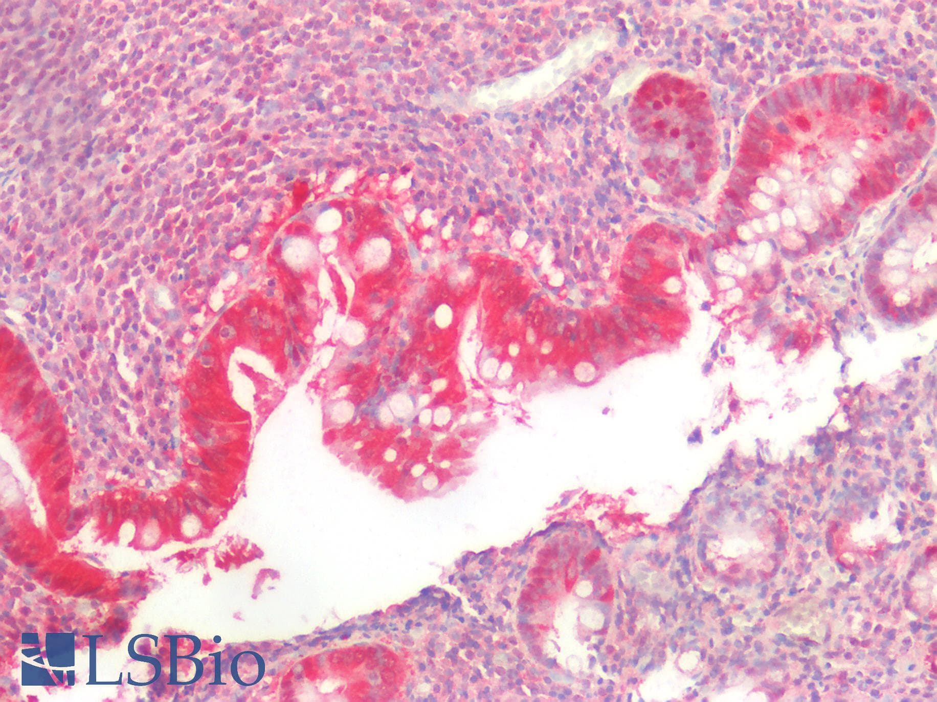 PathPlus™ Polyclonal Rabbit anti-Human MLPH / Melanophilin Antibody (IHC)