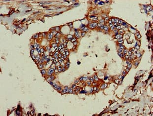 TPD52L2 / HD54 Antibody