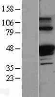 Human SERPINA1 / Alpha 1 Antitrypsin Protein (Over-Expression Lysate Myc-DDK (Flag))