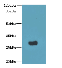 Polyclonal Rabbit anti-Human MORN3 Antibody (WB)
