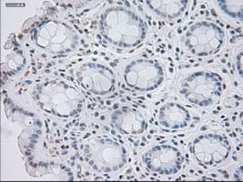 GAD1 / GAD67 Antibody (clone OTI3H2)