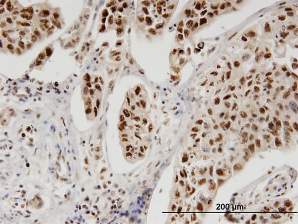 PBK / TOPK Antibody (clone 6E3)