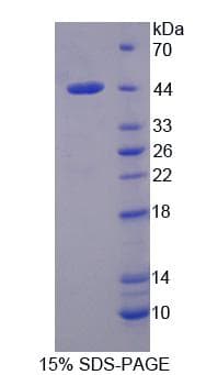 Mouse IL1RAP Protein (Recombinant 6His, N-terminus)