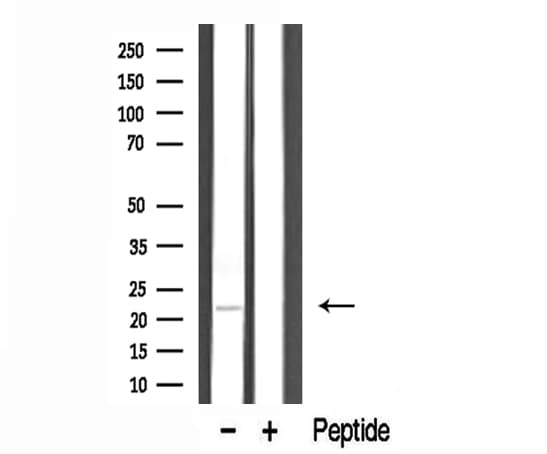Polyclonal Rabbit anti-Human TUSC5 Antibody (IF, WB)