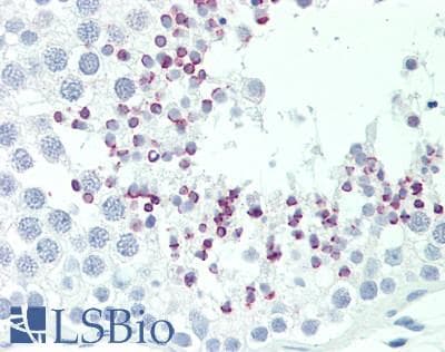 IHC-plus™ DICER1 / Dicer Antibody (aa1175-1225)