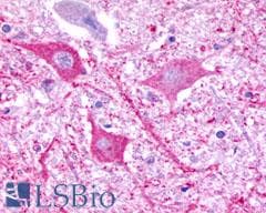 PathPlus™ P2RY8 / P2Y8 Antibody (C-Terminus)