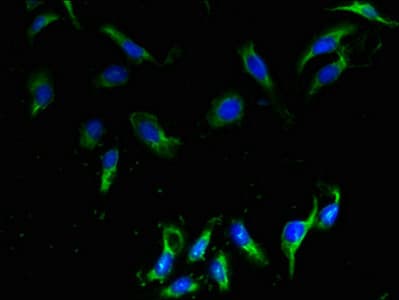 Polyclonal Rabbit anti-Human CMTM2 Antibody