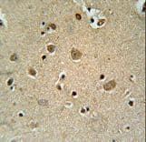 TRIM50 / E3 Ubiquitin Ligase Antibody (aa354-383)